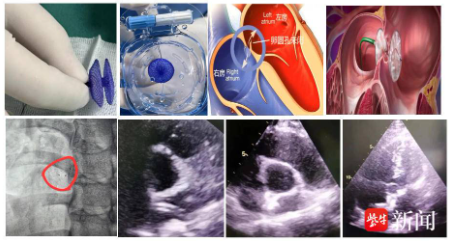 f1bc9e5e-c7d8-4182-bdef-05fff5cfa313