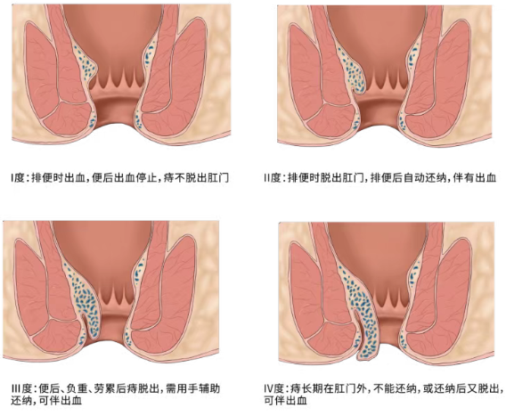 d8ecd943-360b-4559-8ae0-aeea7c908af6