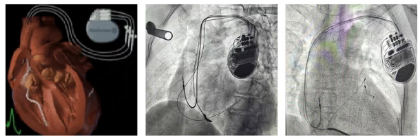 5fca0a93-cc29-4019-b7a5-c2e27d145297